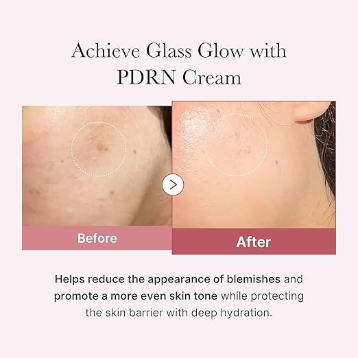PDRN Pink Hyaluronic Moisturizing Cream